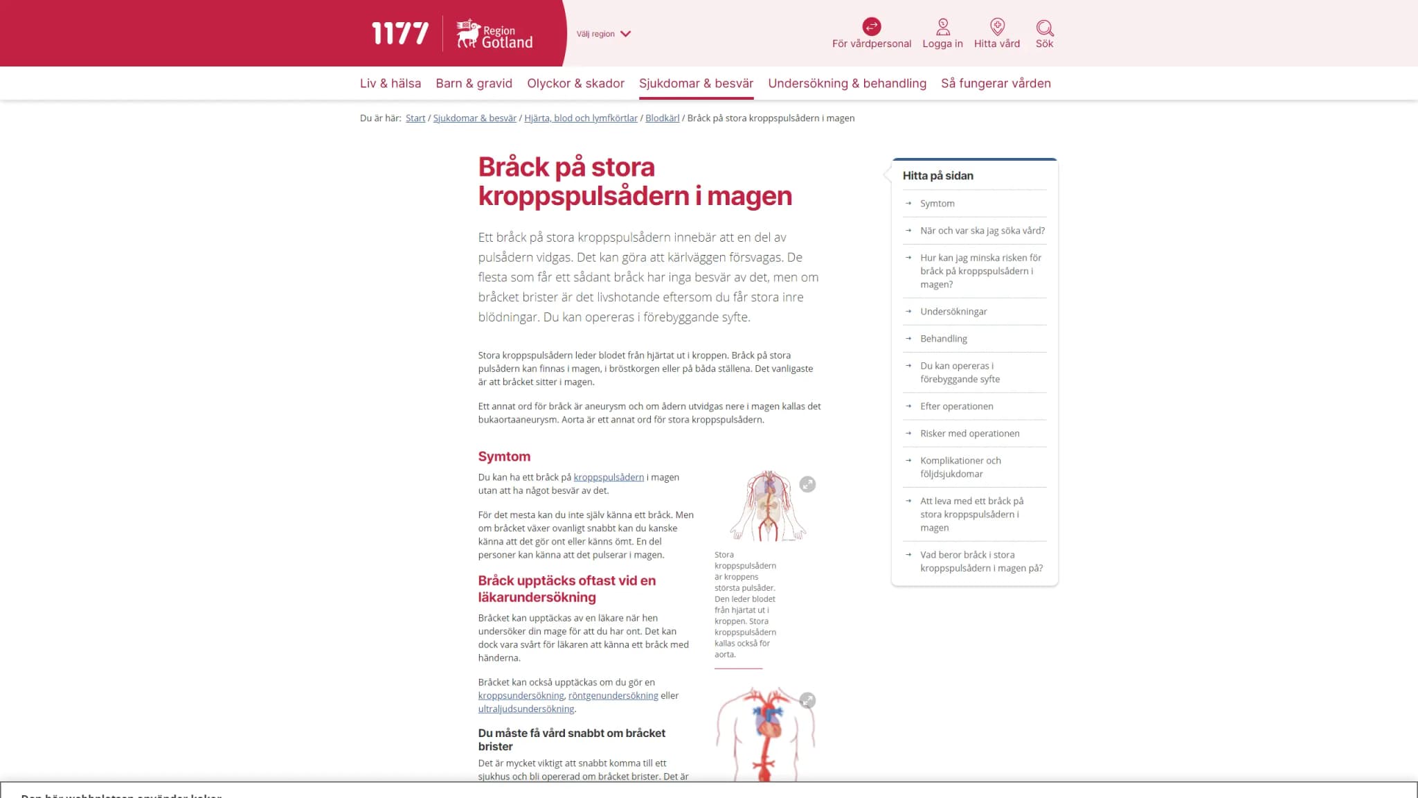 HSA image