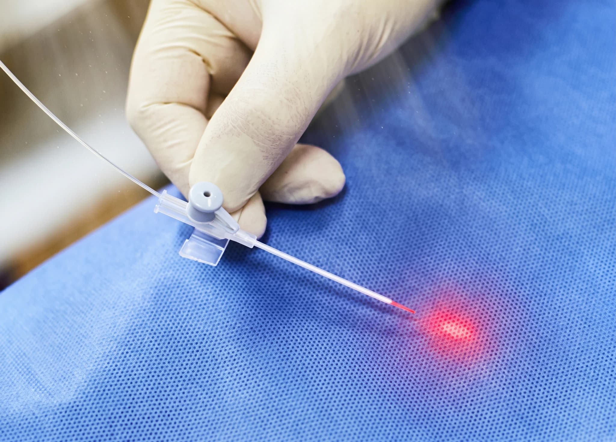 En hand i en vit handske håller en laserkateter ovanför en blå operationsduk, med en röd laserstråle som syns vid spetsen.