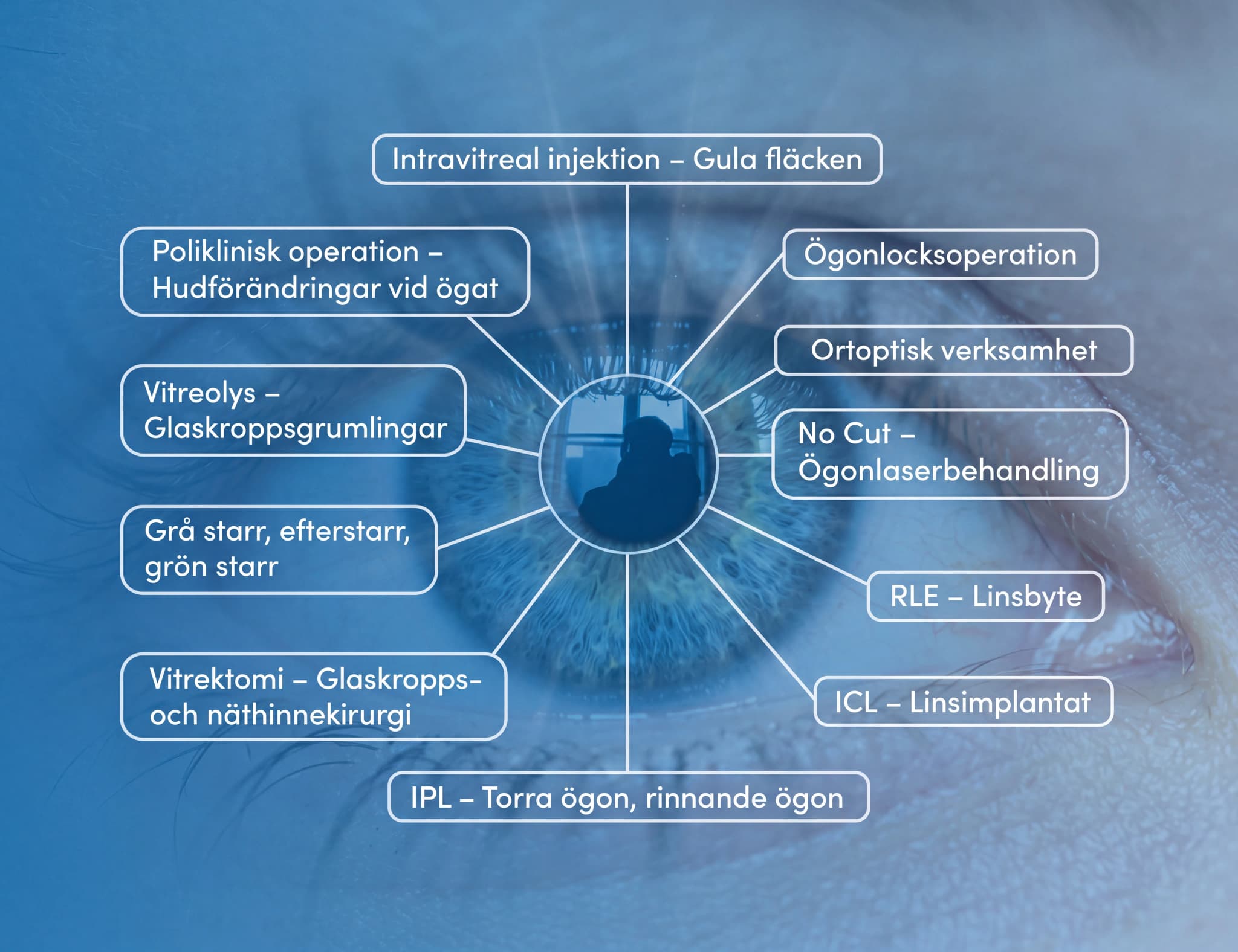 Diagram som illustrerar olika ögonhälsovårdstjänster, arrangerade runt en stiliserad bild av ett öga i blå nyanser.