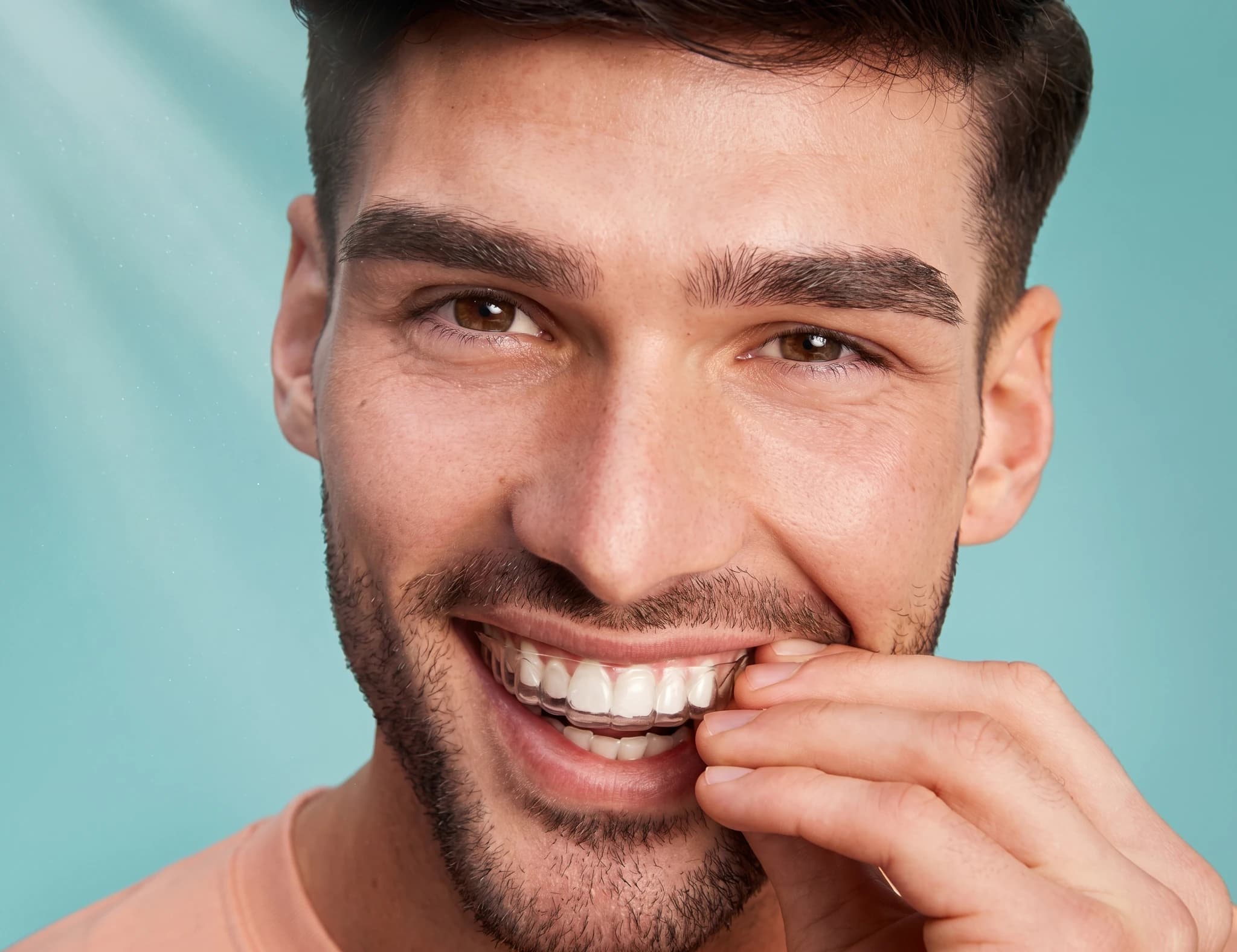 Man i närbild som justerar genomskinliga tandställningar (aligners) över sina tänder.