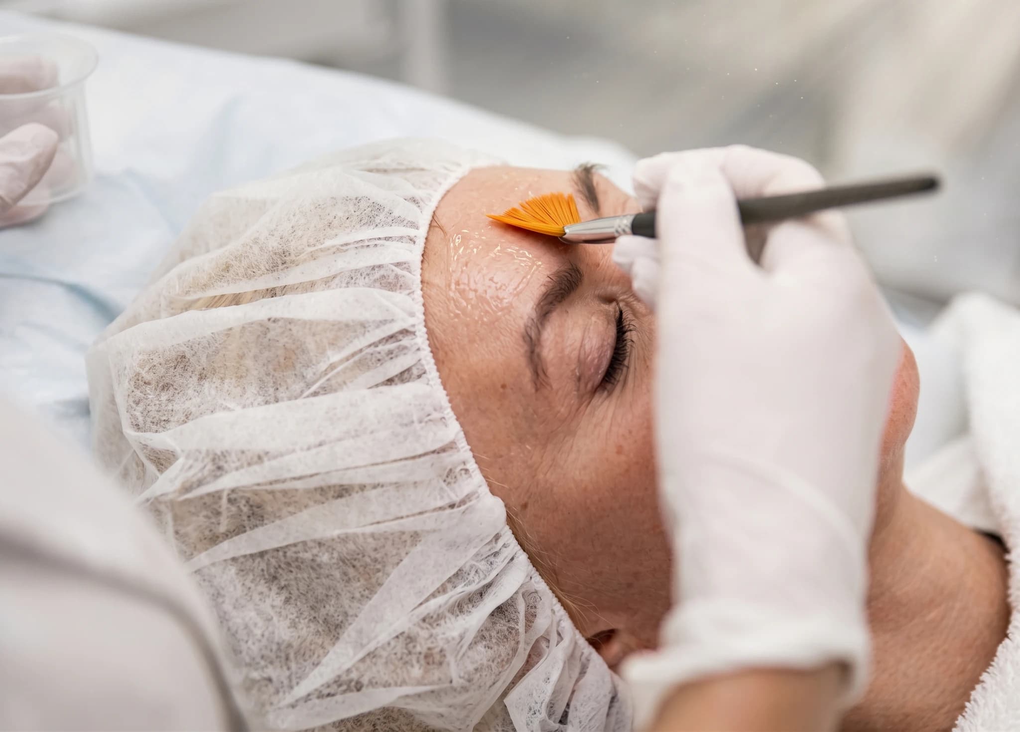 Estetiker applicerar ansiktsmask med borste på kunds panna på en klinik.
