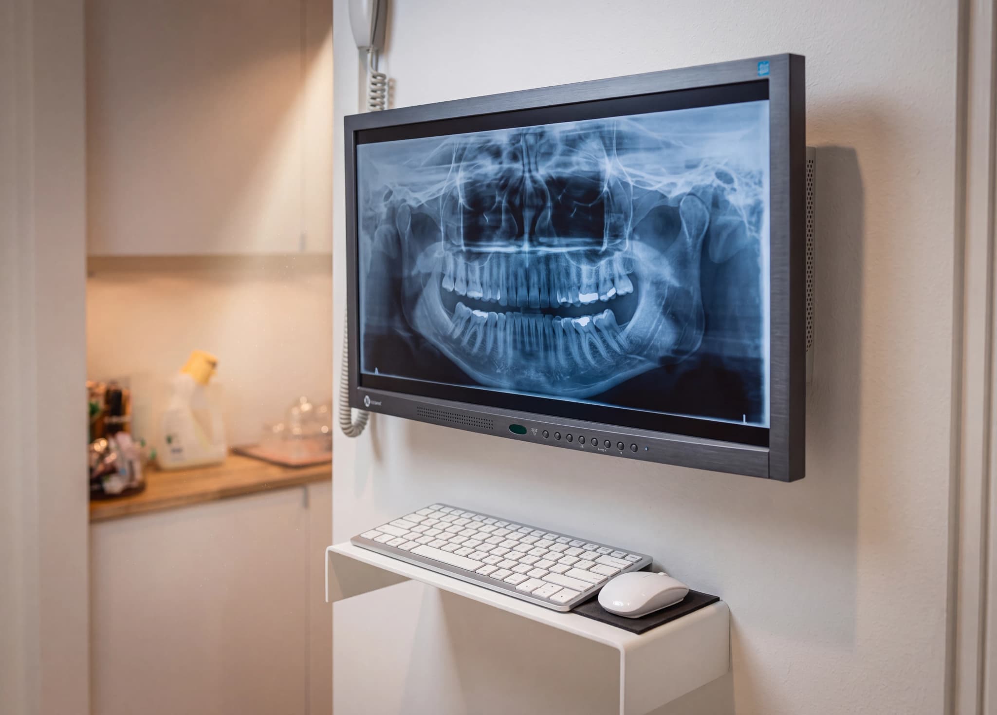 Ett dentalröntgenfoto visas på en datorskärm med ett tangentbord och en mus placerade framför.