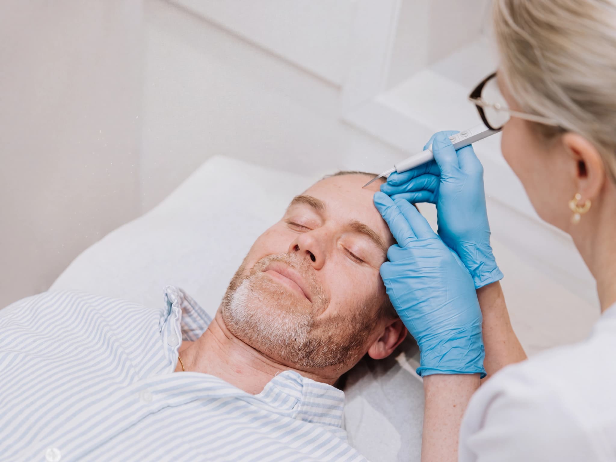 Professionell utför en hårtransplantation på en man som ligger ner på en brits.