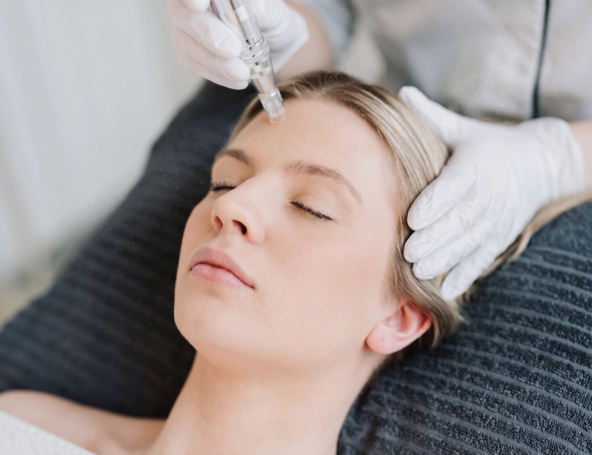 En kvinna får en microneedling-ansiktsbehandling av en professionell i en skönhetsklinik.